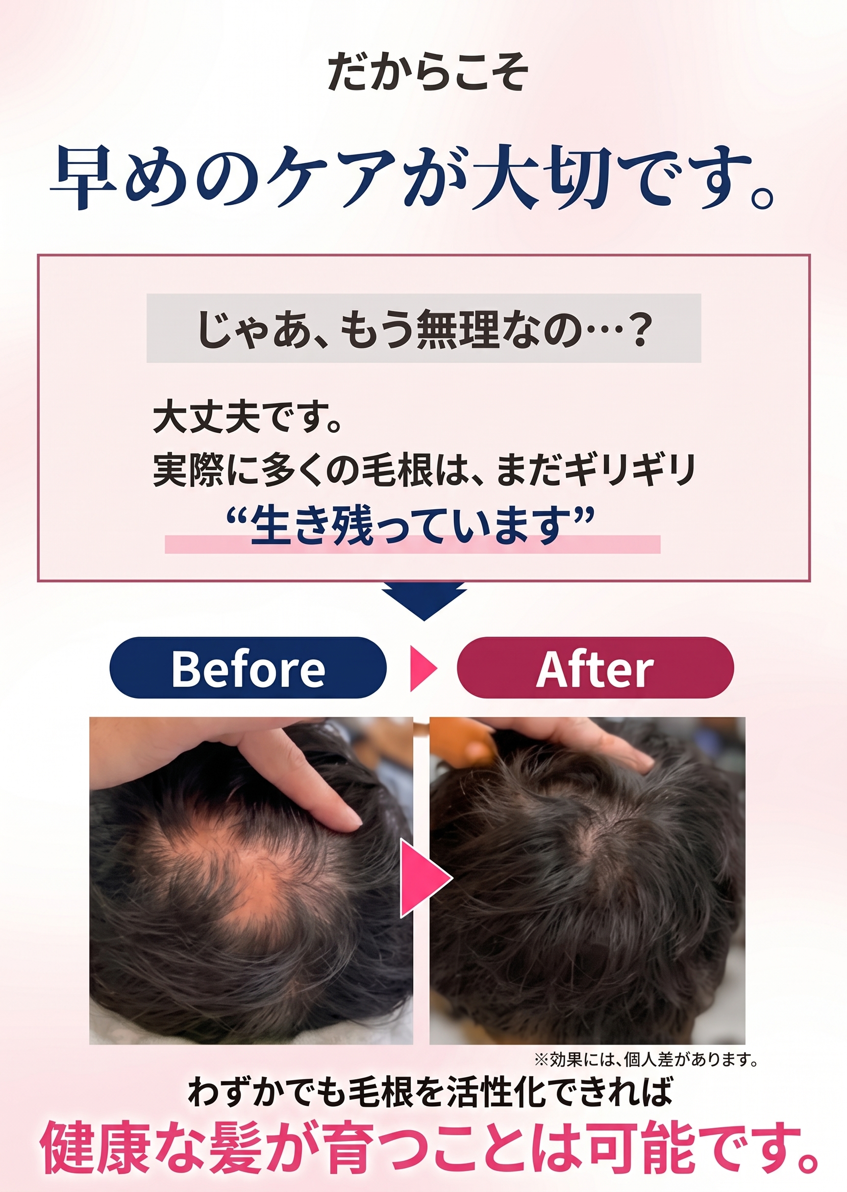 ヘアサイクル2