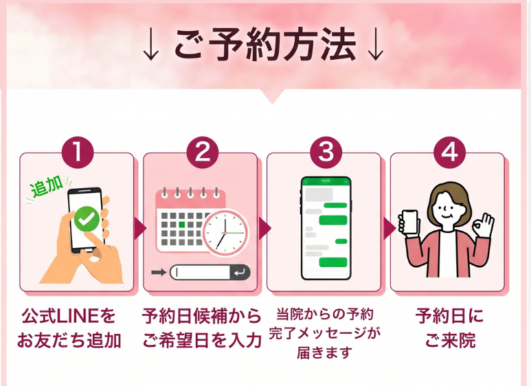 予約方法